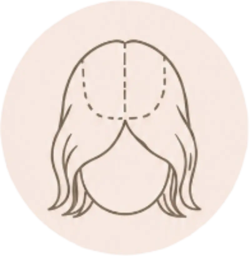 A wig may be worth considering if